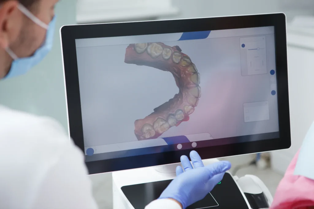 Digitaler 3D-Scan eines Unterkiefers am Monitor, Themenbild zur digitalen Diagnostik in München