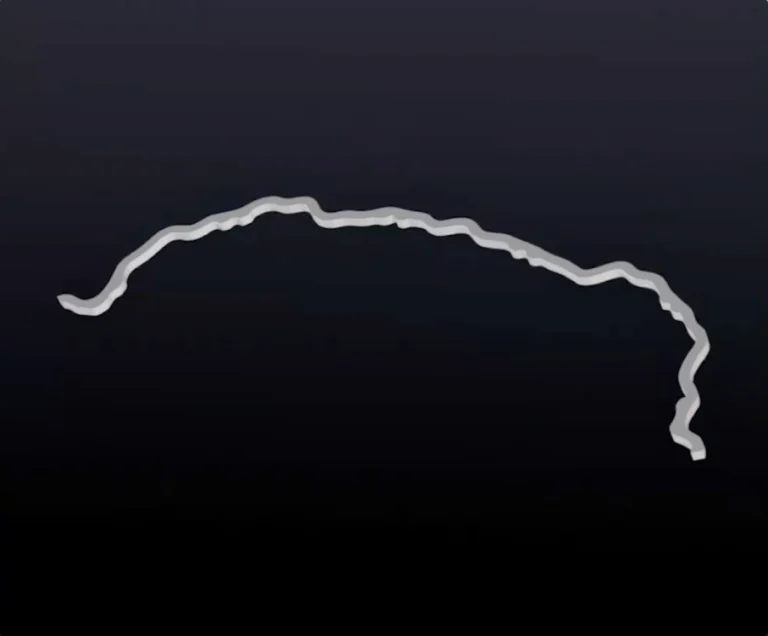 A fixed retainer wire against a dark background; image related to retainers in Munich-Schwabing